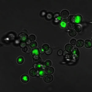 Lokalisation eines Cholintransporters in internen Membranen in Saccharomyces cerevisiae